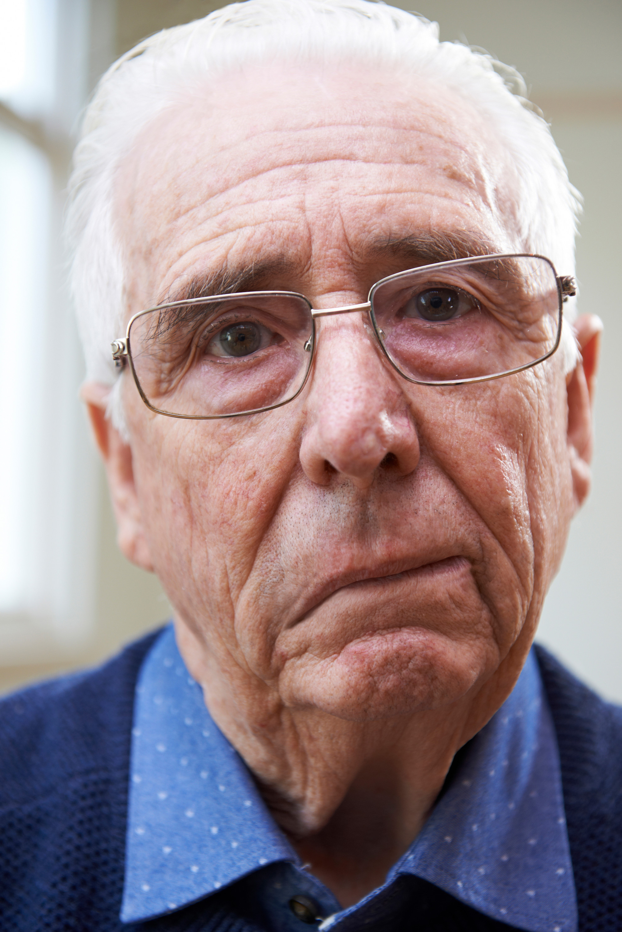 A close up of an older man. The muscles in his face are weak on one side